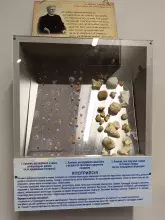 Літотрипсія (дроблення каменів)